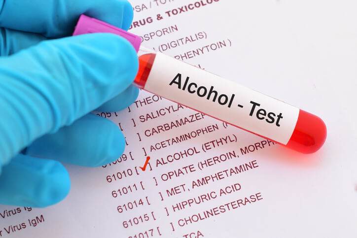 drug and alcohol tester